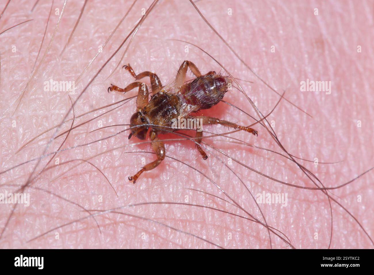 Deer Ked (Lipoptena cervi), Insecta, Arendal, Norwegen, on my head ...